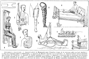 Eine Schwarz-Weiß-Zeichnung eines Mannes in einem Krankenhausbett mit einem Gips an seinem Bein, umgeben von Bildern von Menschen, einer Person auf einem Stuhl und verschiedenen Gegenständen, mit dem Text "Arm- und Beinfrakturen" unten.